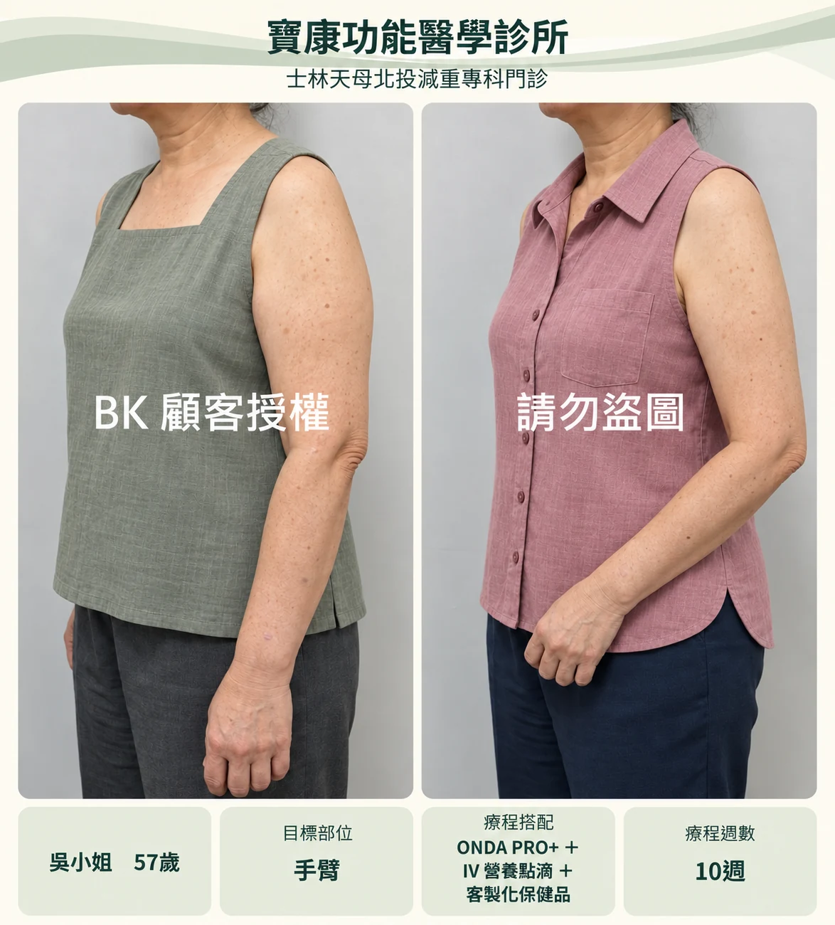 手臂服裝調整設計示意,非原始療效紀錄