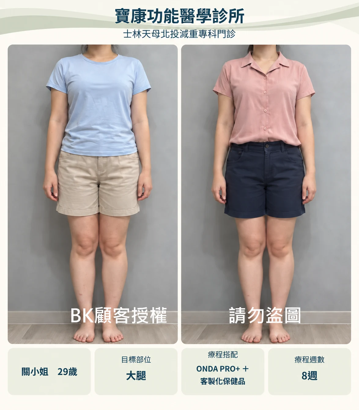 大腿服裝調整設計示意,非原始療效紀錄