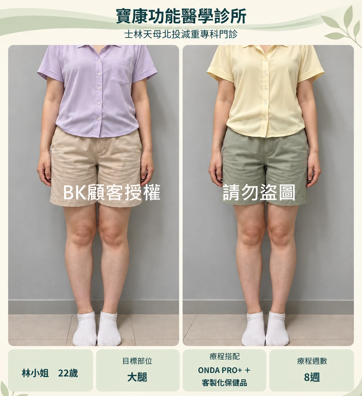 大腿服裝調整設計示意,非原始療效紀錄
