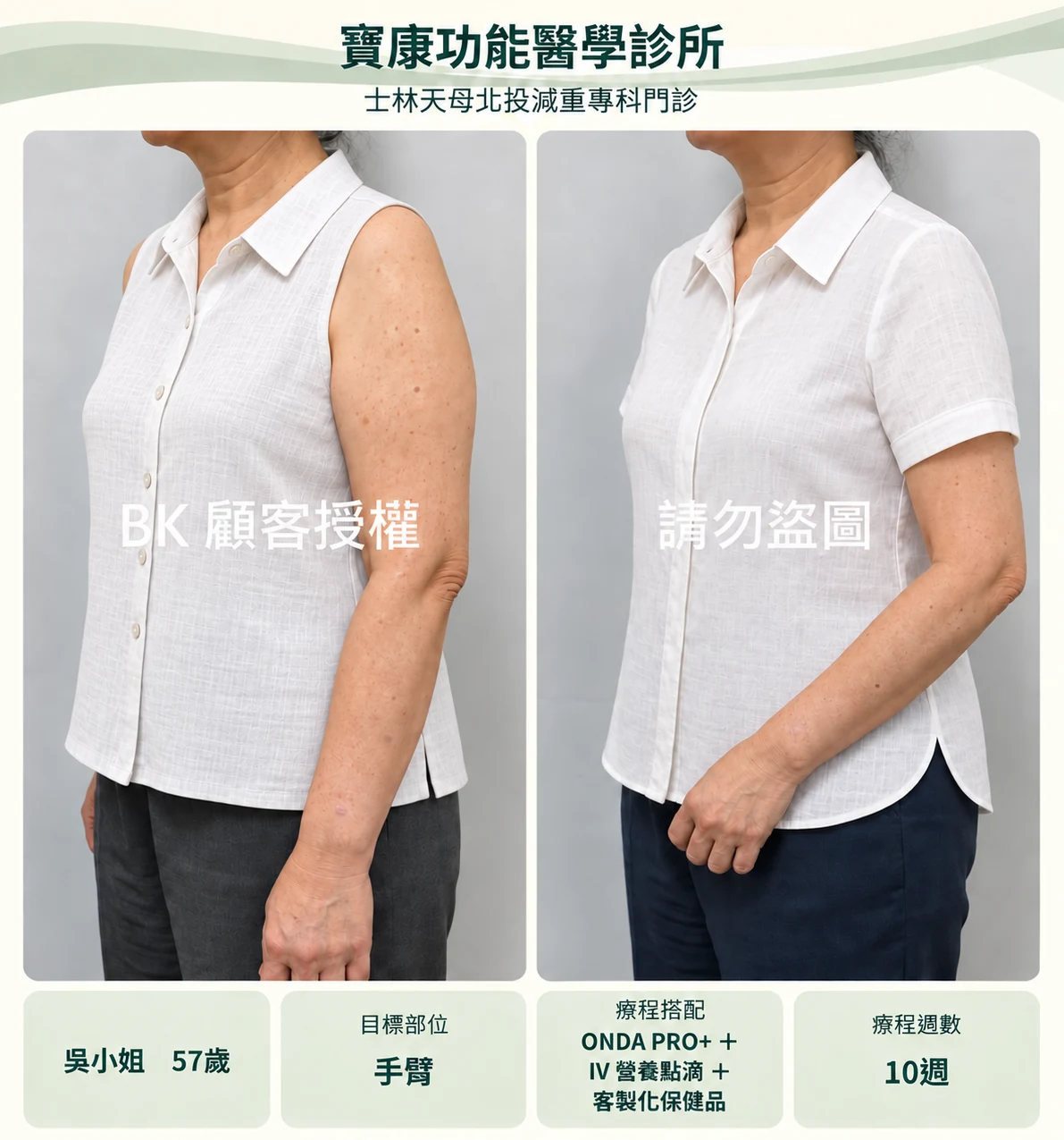 手臂服裝調整設計示意,非原始療效紀錄