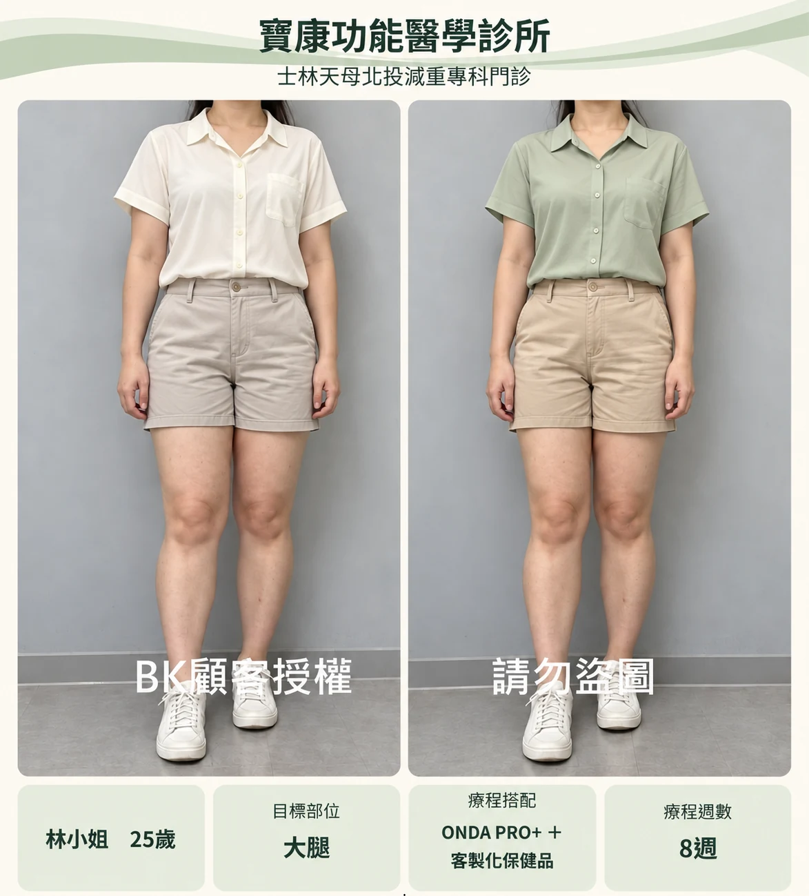 側腹服裝調整設計示意,非原始療效紀錄