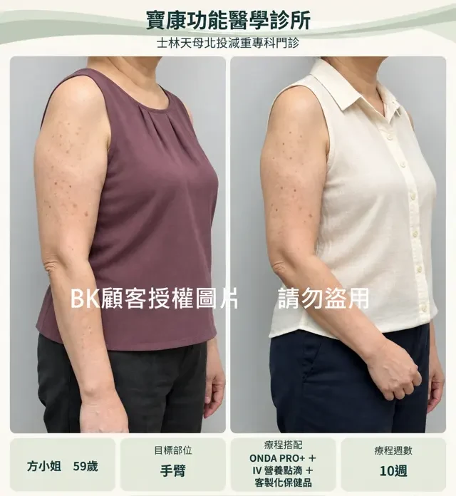 後腰服裝調整設計示意,非原始療效紀錄